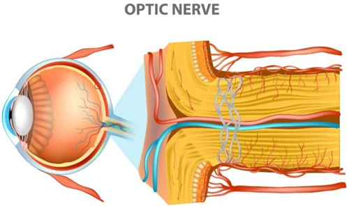 眼睛视神经萎缩表现