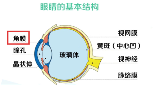 蕾明视康视全极三焦点人工晶状体是国产的,远中近视力和视觉质量都非常好!