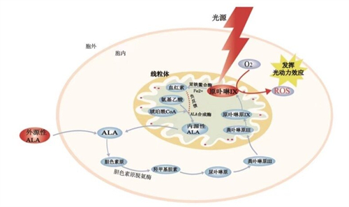 光动力治疗黄斑眼病原理图解