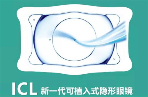 ICL介绍