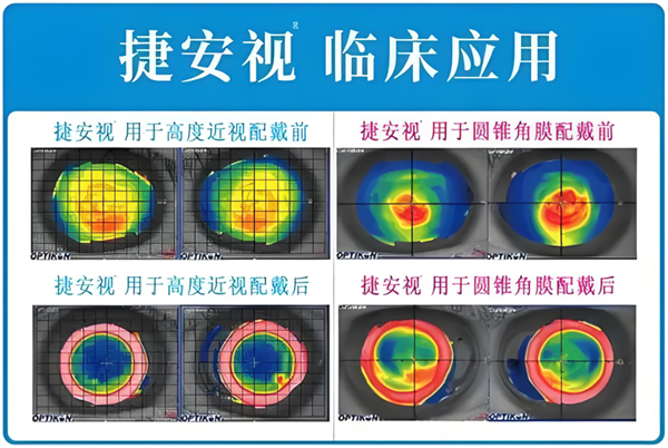 捷安视应用