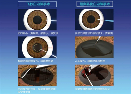 云南邵通白内障免费手术政策新消息!免费和补助名额符合条件均可申请