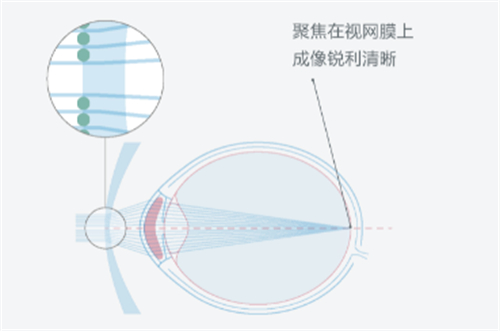 依视路星趣控镜片的优势图解