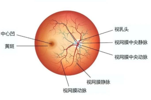 眼底病包括的疾病示意图