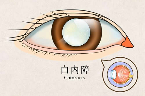 北京同仁眼科医院在线问询-北京同仁眼科医院电话询问号码-同仁眼科电话预约挂号攻略流程!