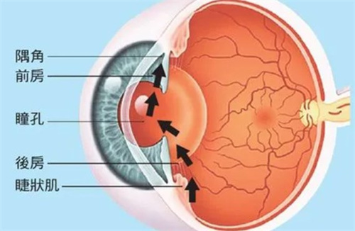青光眼眼压高的原因