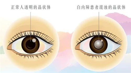 同仁眼科挂号太难了!同仁眼科挂号网上预约挂号/同仁眼科人工热线电话挂号攻略分享!